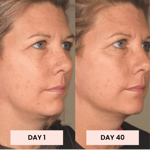 TAFFL Artisan: The 7-Layer Penetration System™ – LED and EMS Skin Rejuvenator + FREE Gift