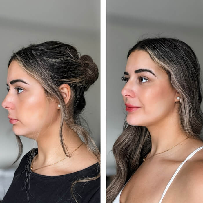 TAFFL Artisan: The 7-Layer Penetration System™ – LED and EMS Skin Rejuvenator + FREE Gift